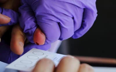 Metabolon’s Validation of Dried Blood Spot (DBS) Cards for Metabolomics Analysis